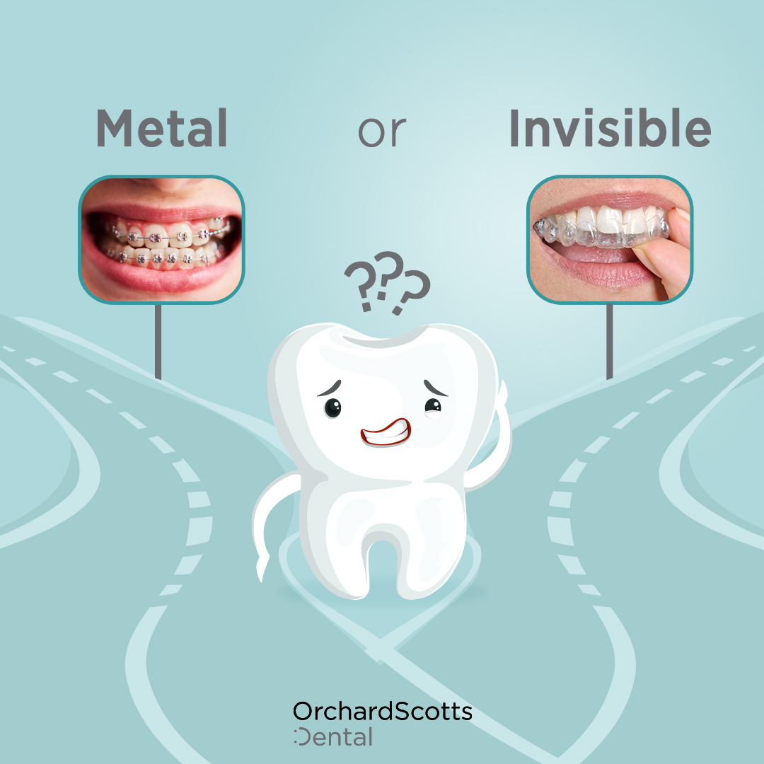 Metal or Invisible Braces: What's Best for You - Orchard Scotts