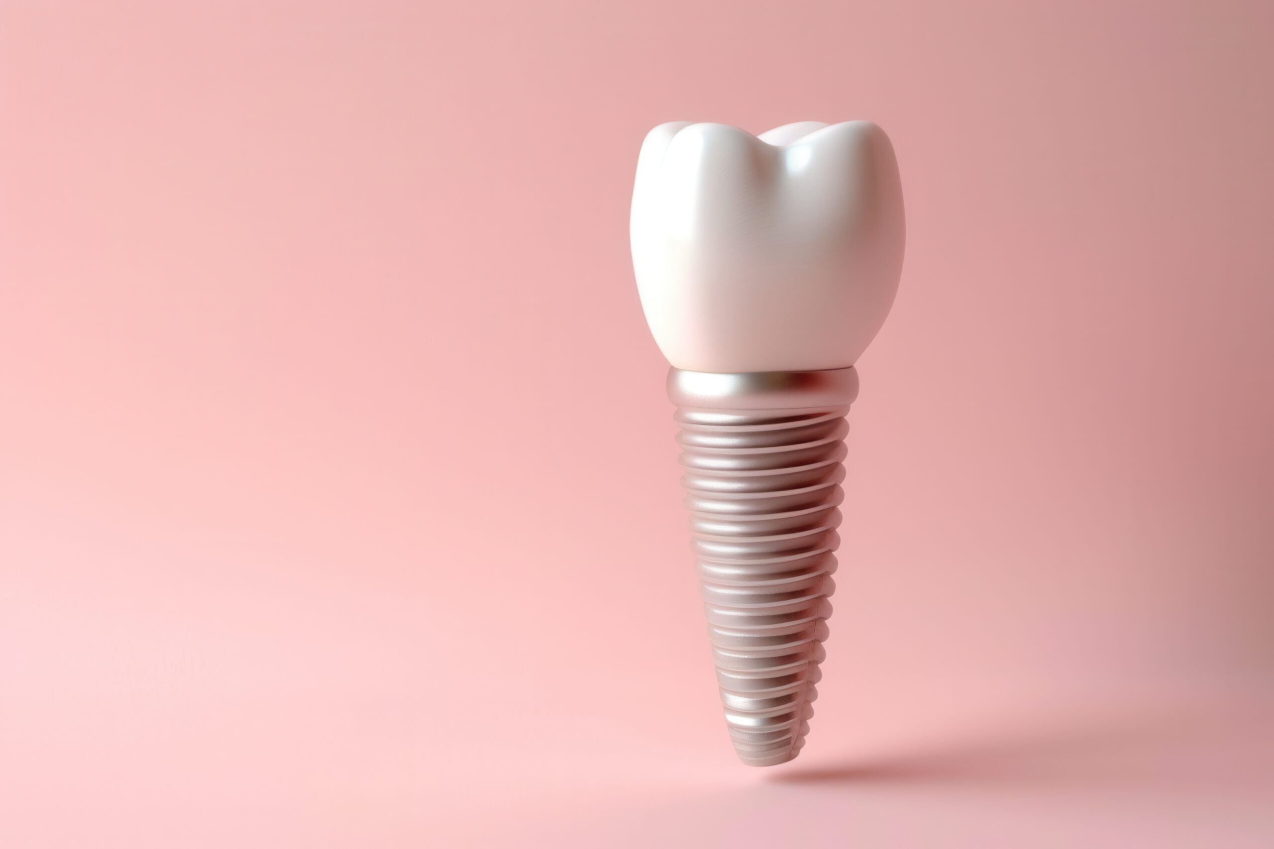 What influences the cost of tooth implants in Singapore?