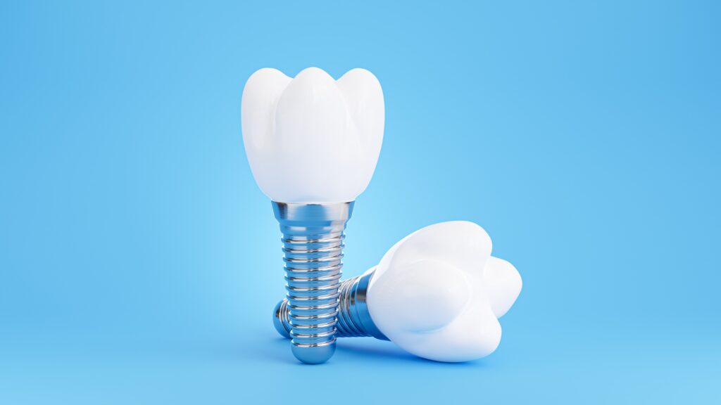 tooth implant cost singapore