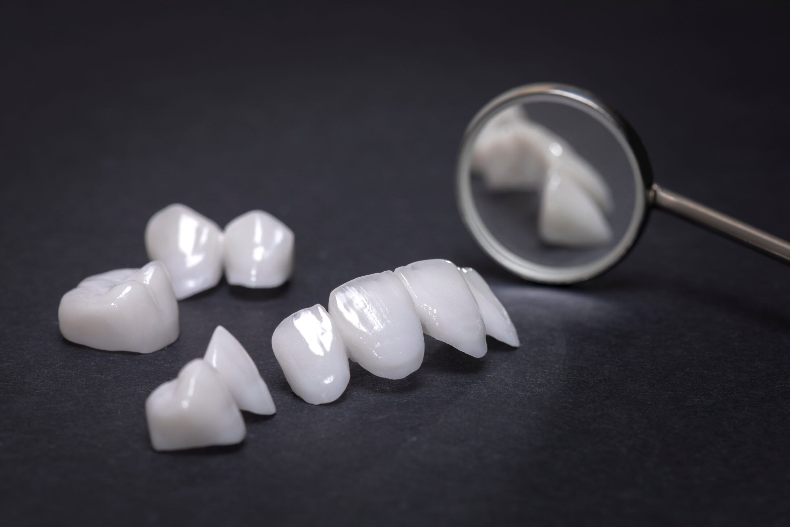 Can Porcelain Veneers Be Removed Without Drilling?