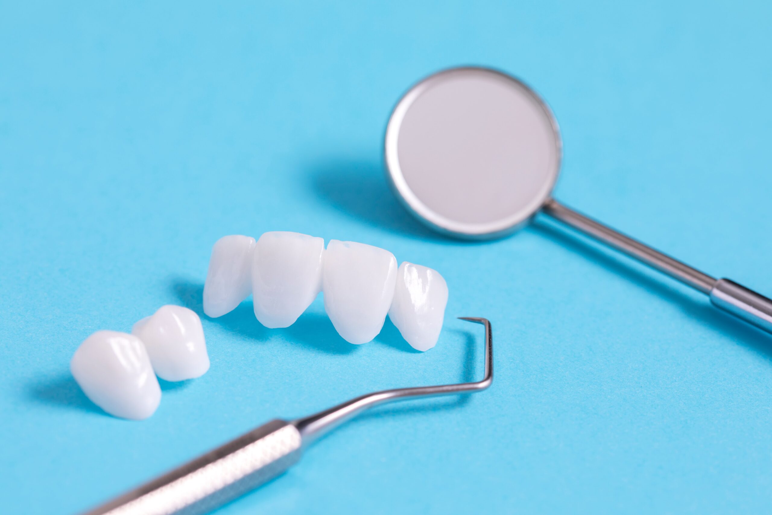 Cost Comparison: Porcelain vs Composite Veneers